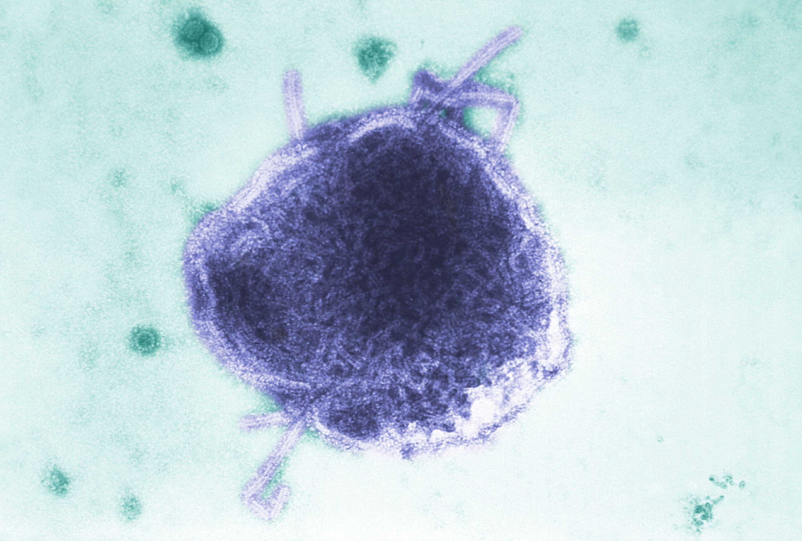 Alberta surpasses 700 confirmed measles cases